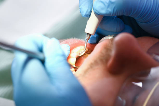 Best Urgent Dental Care for Toothache in Petoskey, MI