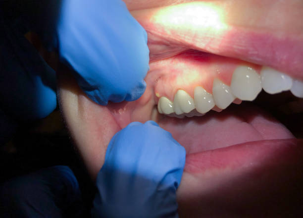 Best Emergency Cosmetic Dentistry in Petoskey, MI