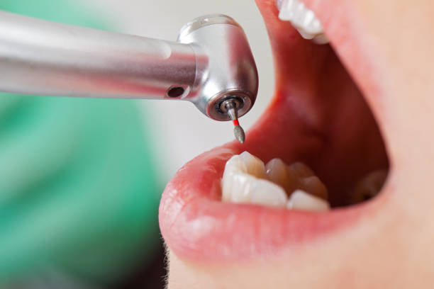 Best Urgent Dental Care for Toothache in Petoskey, MI